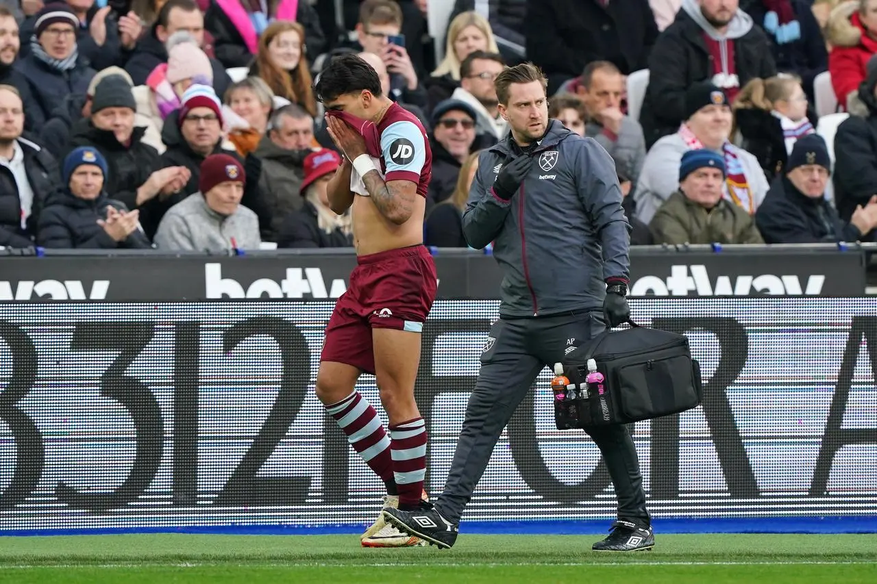 West Ham United v Bristol City – Emirates FA Cup – Third Round – London Stadium