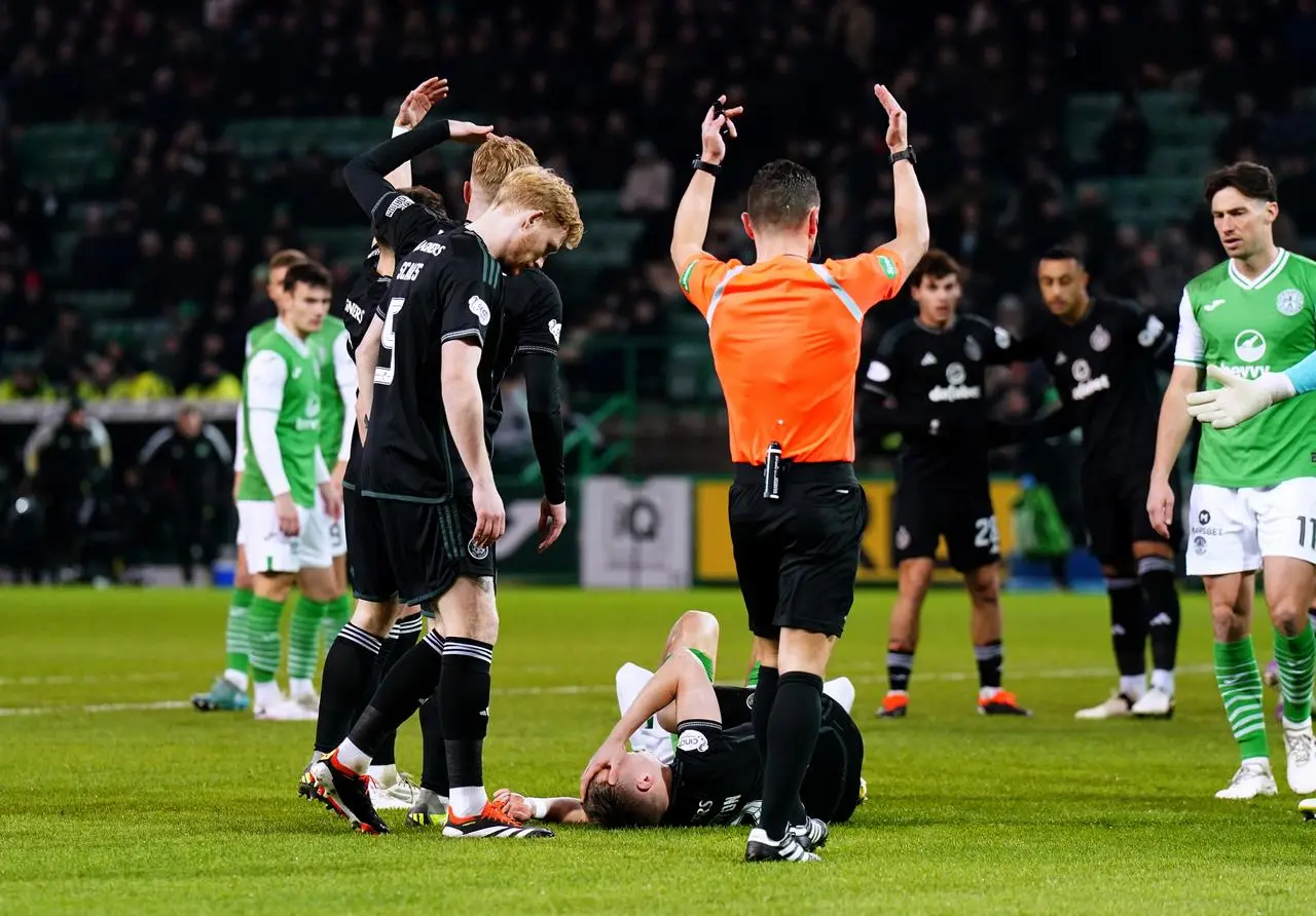 Hibernian v Celtic