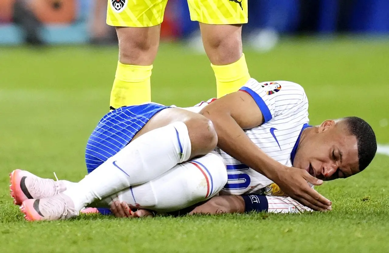 France’s Kylian Mbappe lies injured on the pitch at Euro 2024 with a broken nose