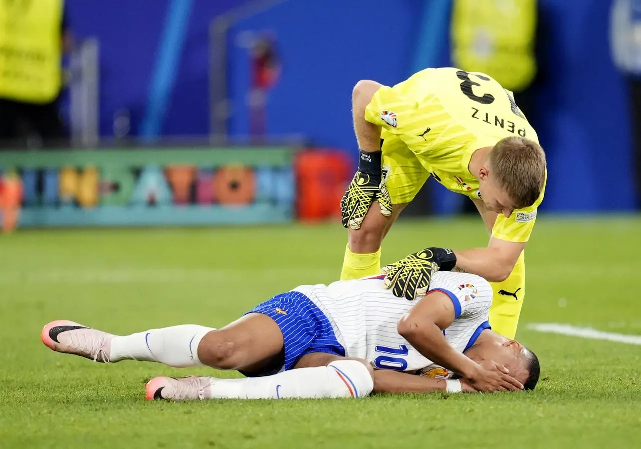 Kylian Mbappe suffers a facial injury during France's 1-0 win over Austria