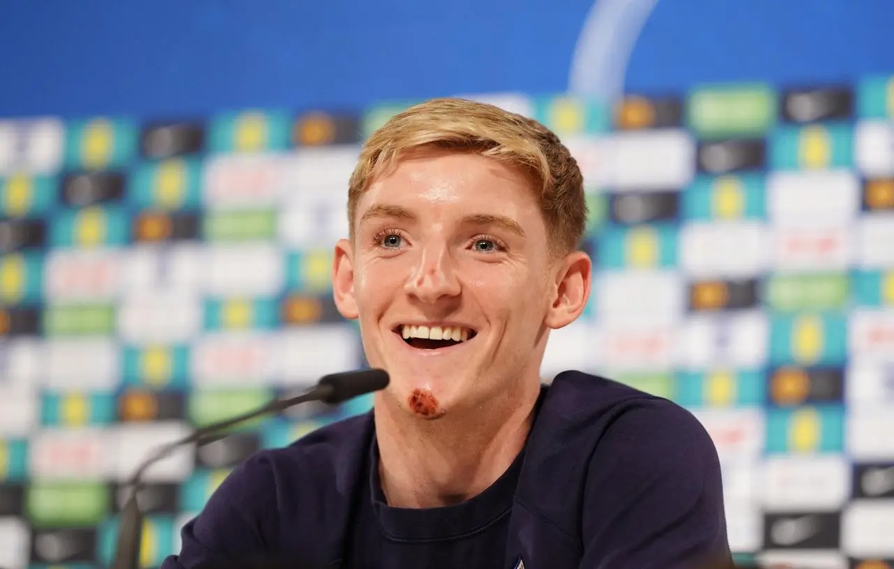 Anthony Gordon, with a cut o his chin, laughs during an England press conference