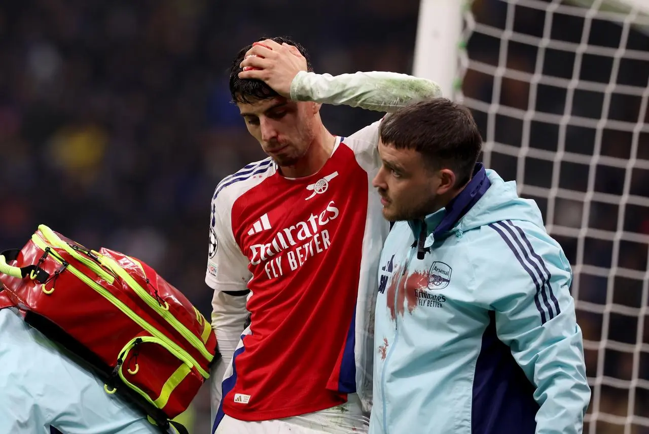 Kai Havertz holds his head after suffering a cut