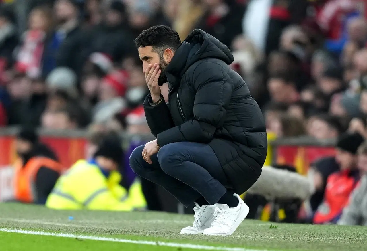 Manchester United manager Ruben Amorim looks frustrated