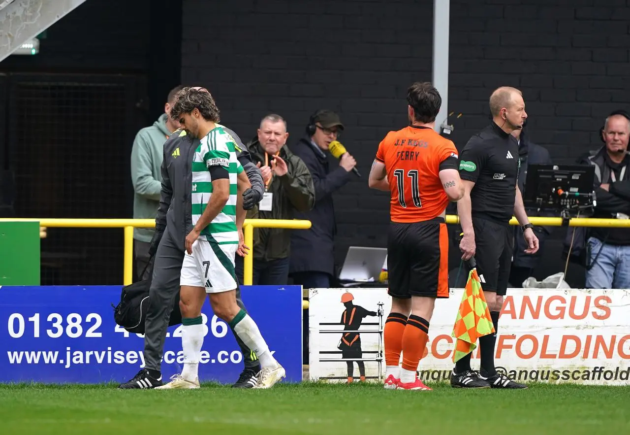 Jota limps off the Tannadice pitch with a Celtic physio