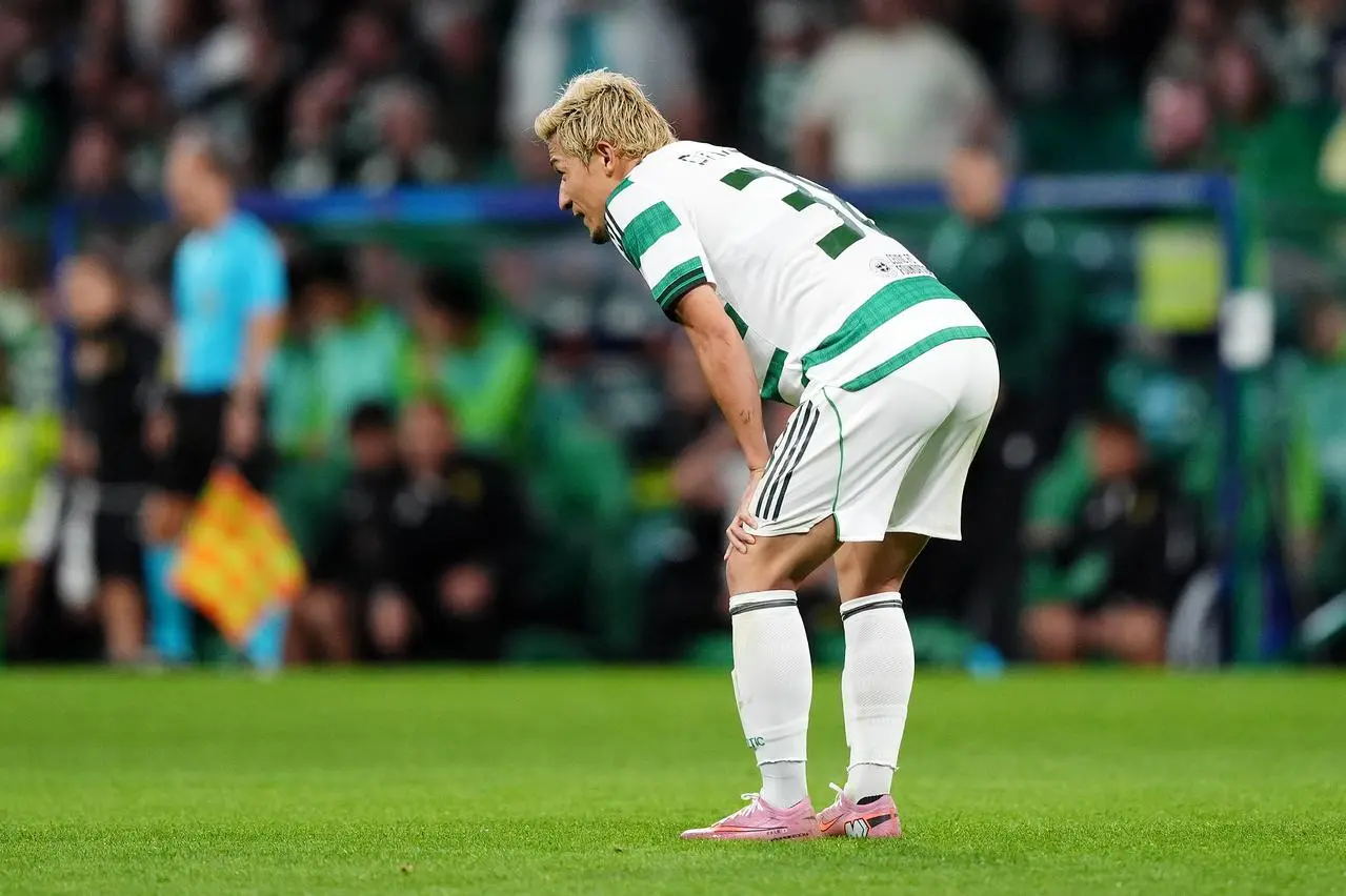 Celtic’s Daizen Maeda reacts after a missed opportunity