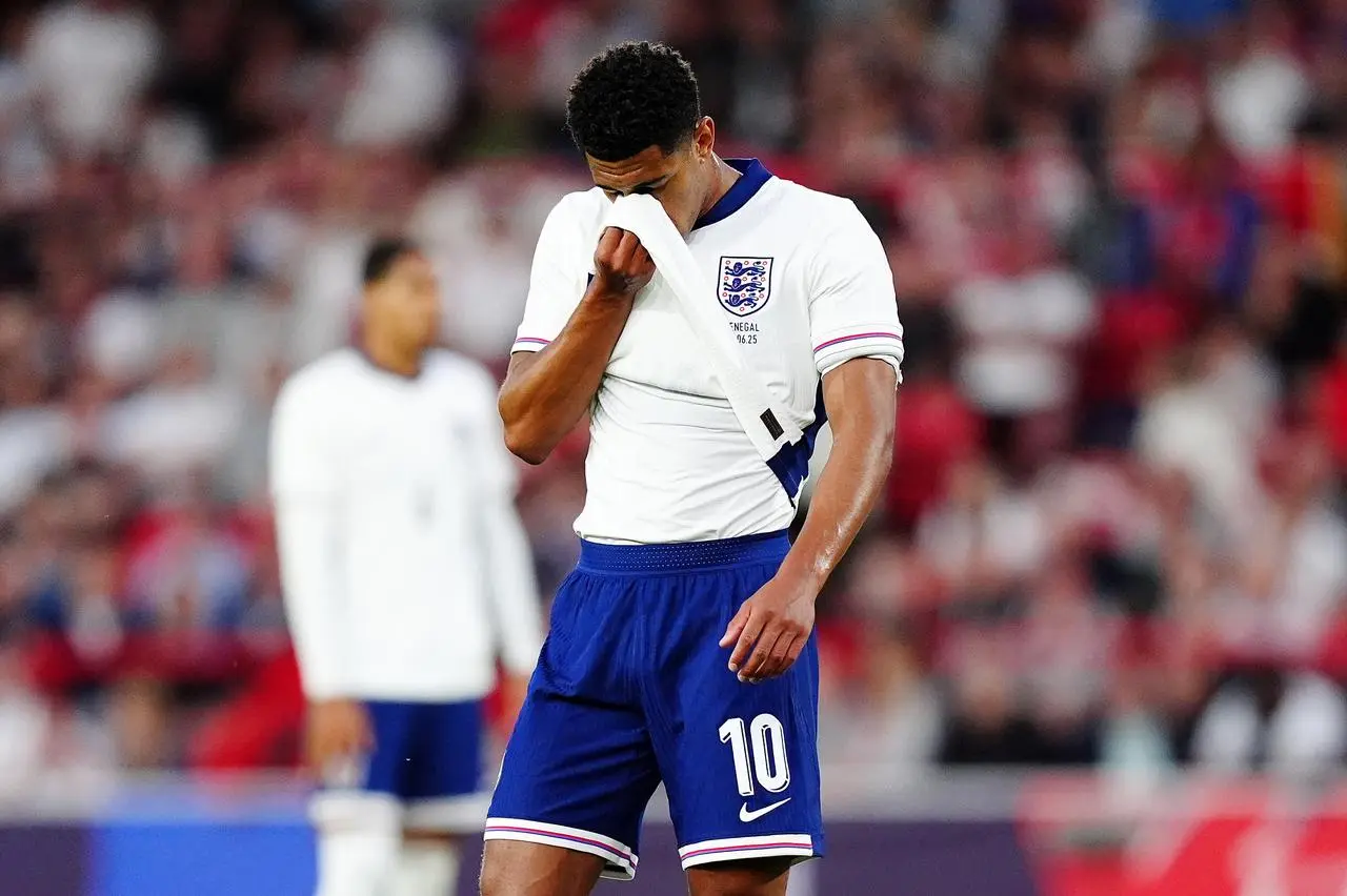 England’s Jude Bellingham covers his face with his shirt