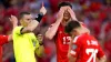 Kieffer Moore was sent off against Turkey (Adam Davy/PA)